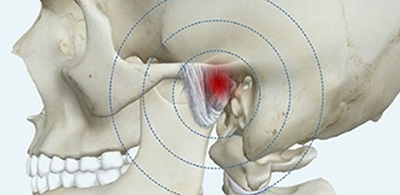 Dor Orofacial E Disfuno Da Articulao Temporomandibular Atm