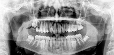 Cirurgias Dentrias 2